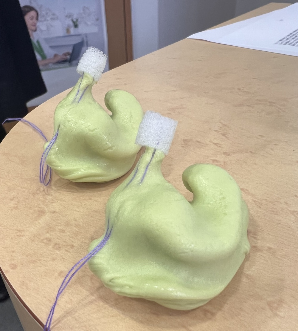 My ear impression